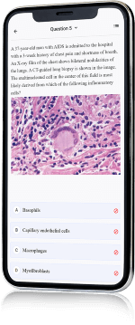 NEET PG Clinical Questions